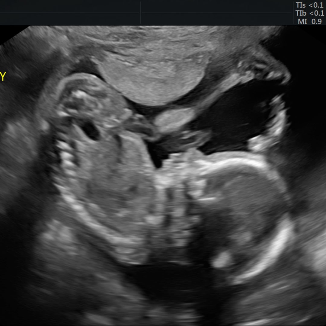 Photo shared by Mary for their Babylist baby registry.