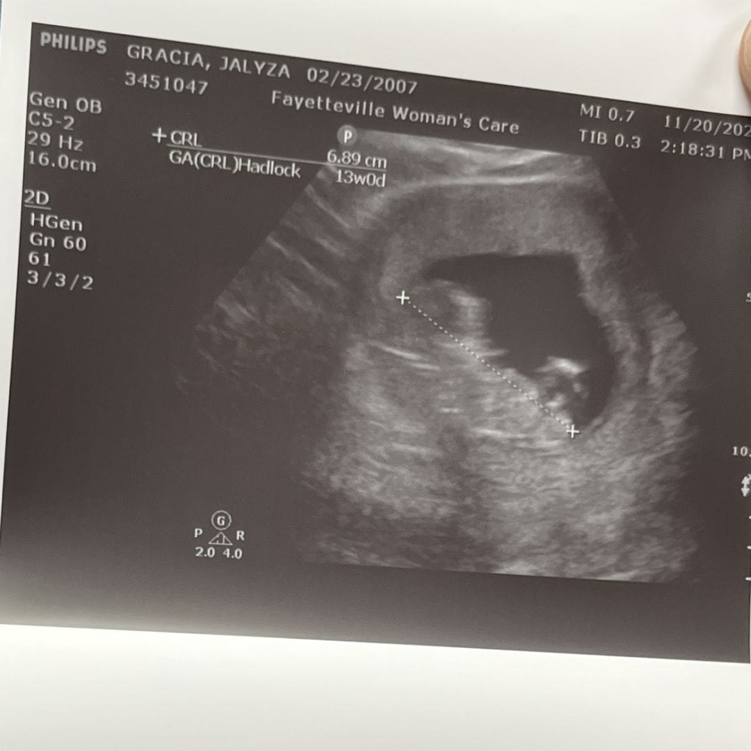 Photo shared by Jalyza for their Babylist baby registry.