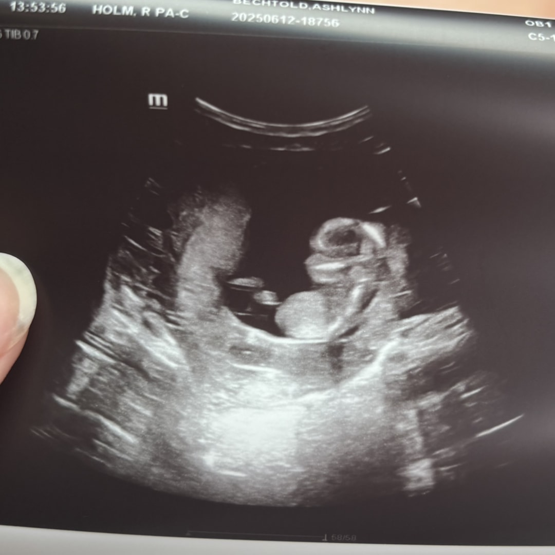 Photo shared by Ashlynn for their Babylist baby registry.