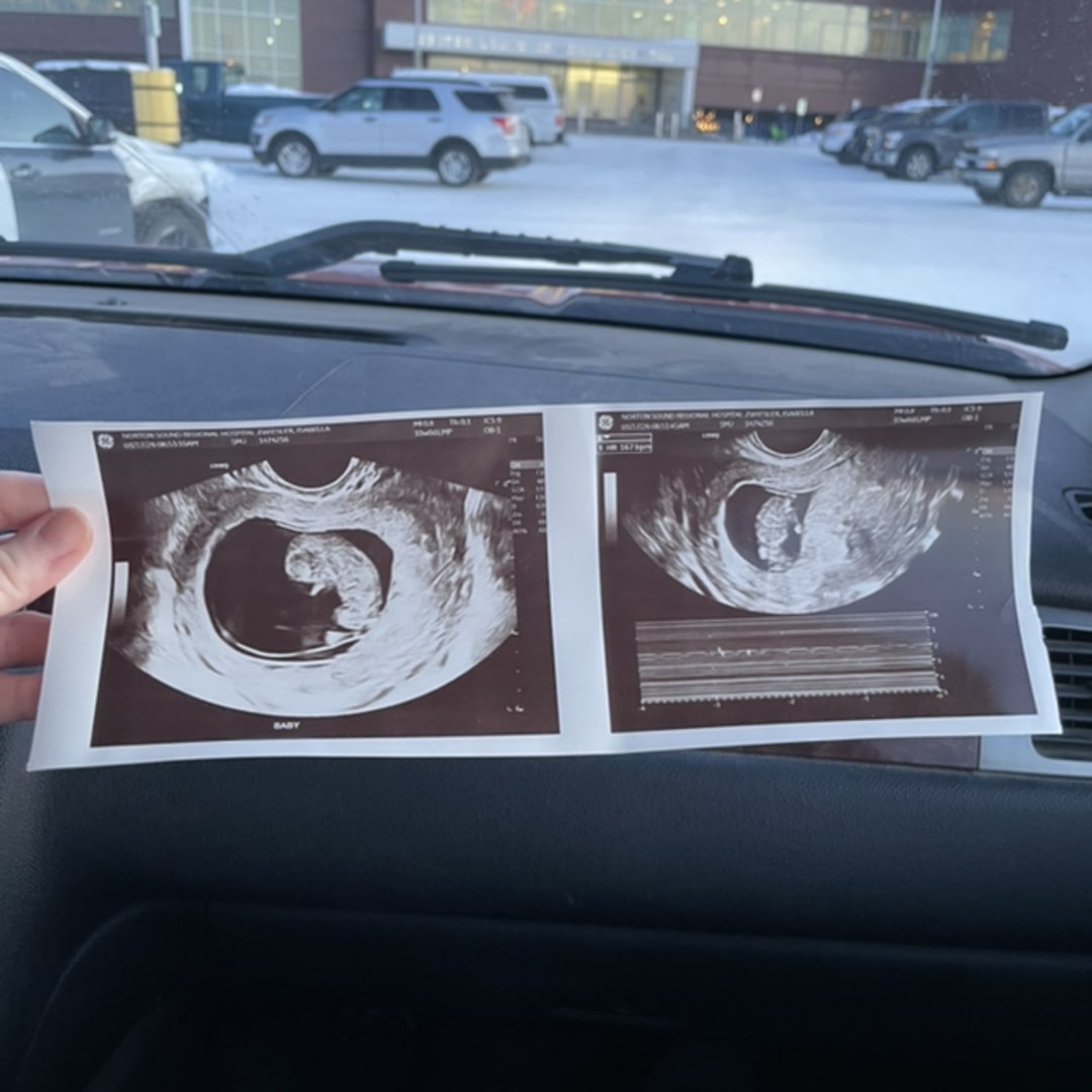 Photo shared by Isabella for their Babylist baby registry.