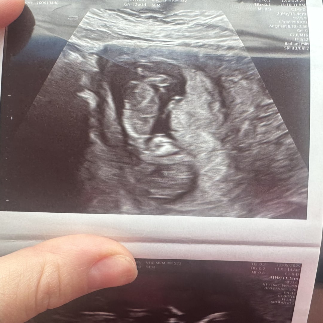 Photo shared by Angela for their Babylist baby registry.