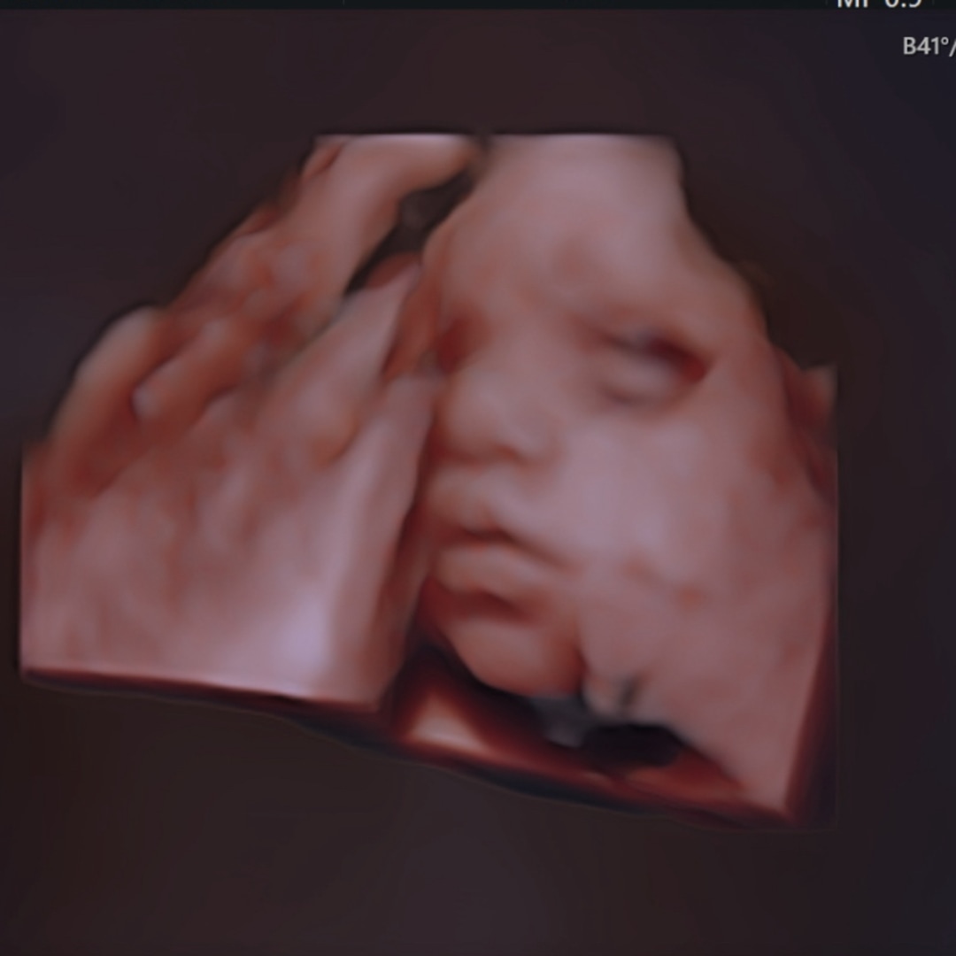 Photo shared by Jade for their Babylist baby registry.