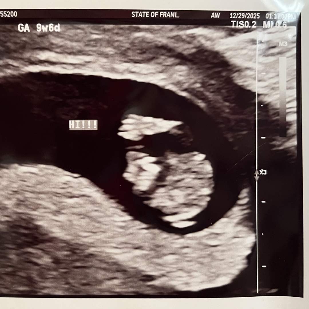 Photo shared by Megan for their Babylist baby registry.