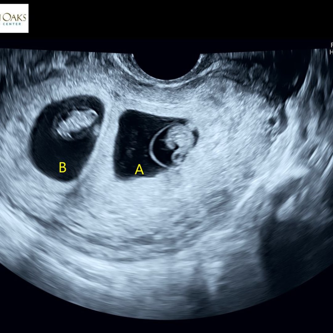 Photo shared by Sarah for their Babylist baby registry.