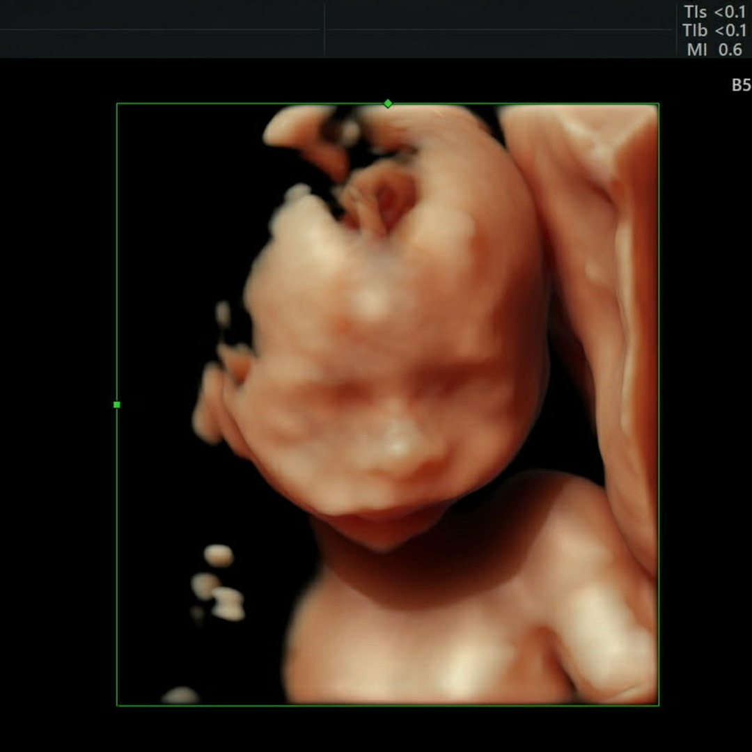 Photo shared by Tia for their Babylist baby registry.