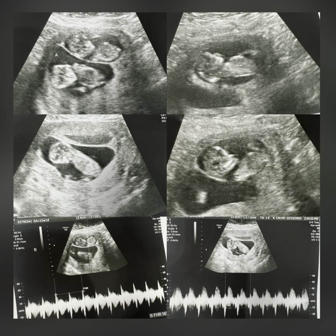 Photo shared by Samantha for their Babylist baby registry.