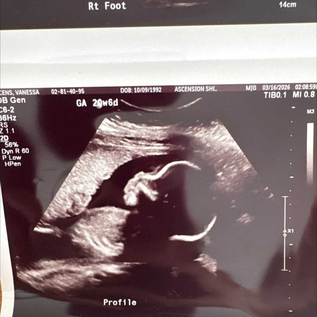 Photo shared by Vanessa for their Babylist baby registry.