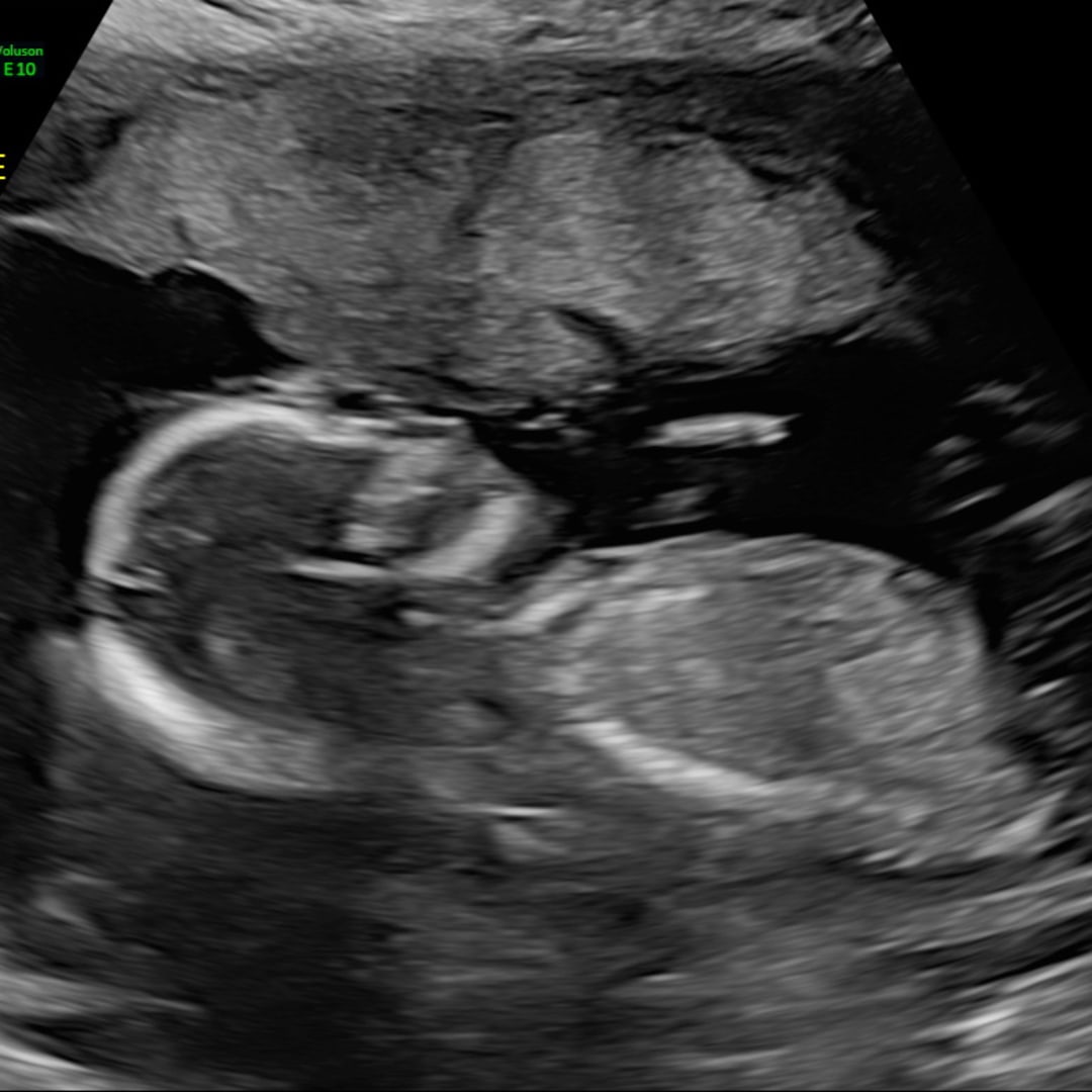 Photo shared by Zanayra for their Babylist baby registry.