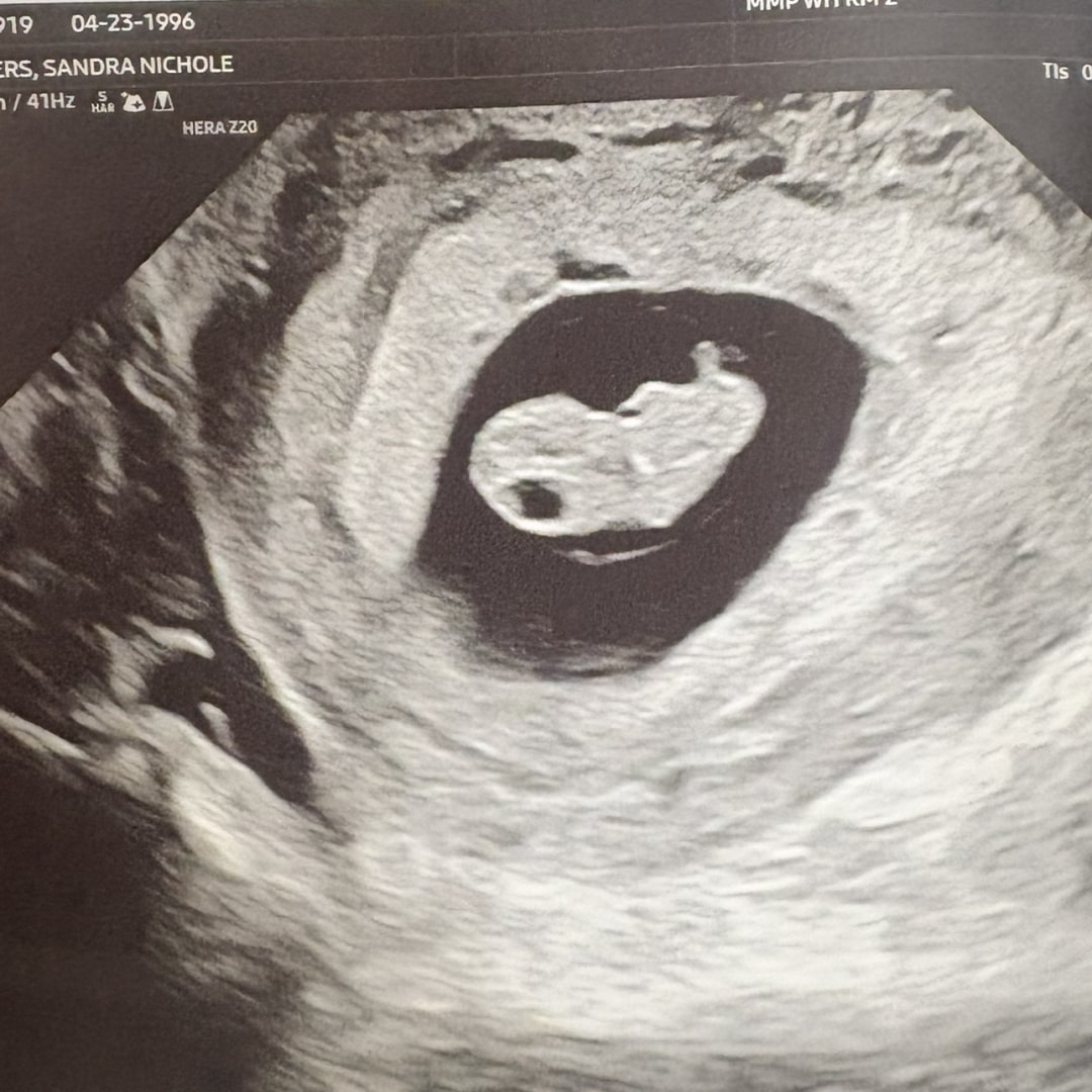 Photo shared by Sandi for their Babylist baby registry.