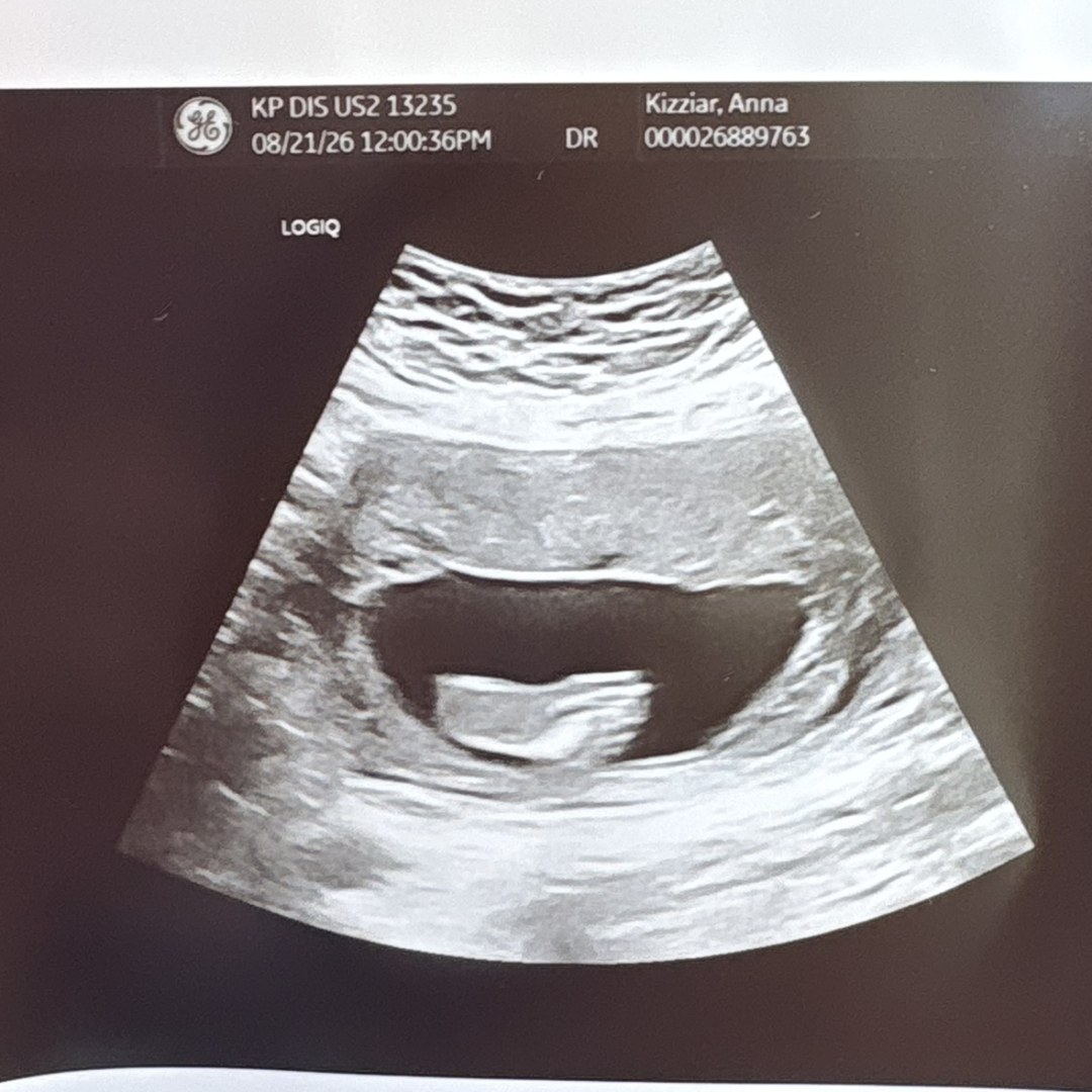 Photo shared by Anna for their Babylist baby registry.