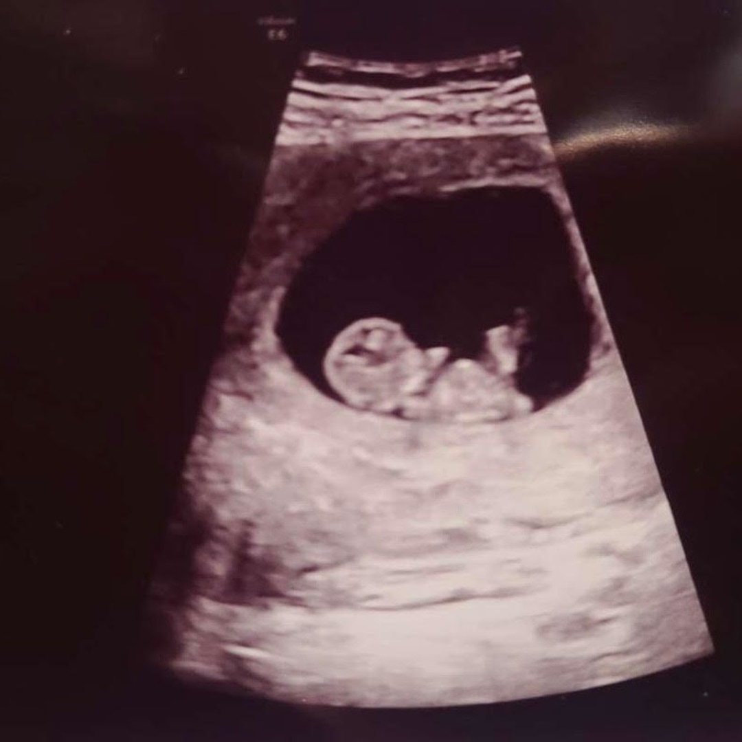 Photo shared by Kristin for their Babylist baby registry.