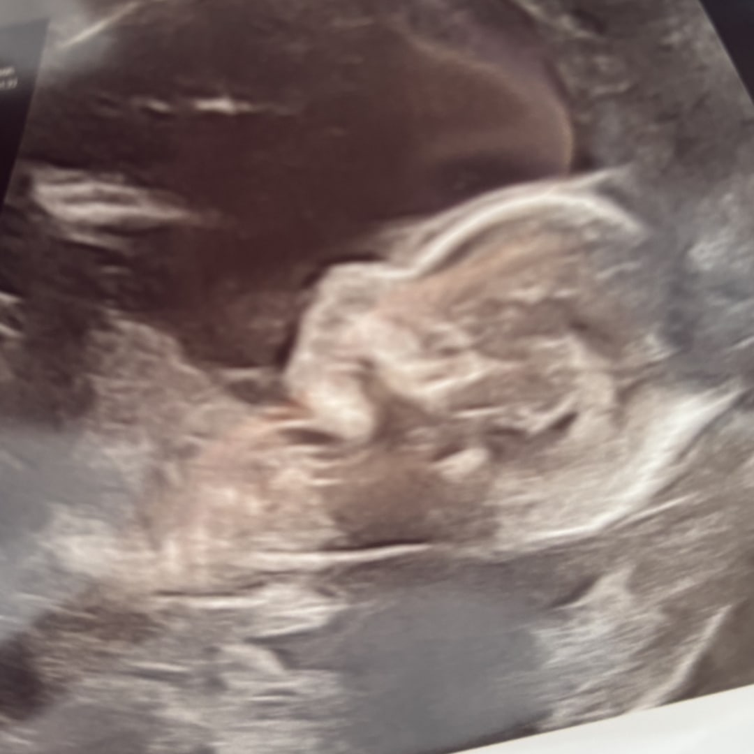 Photo shared by Stephanie for their Babylist baby registry.