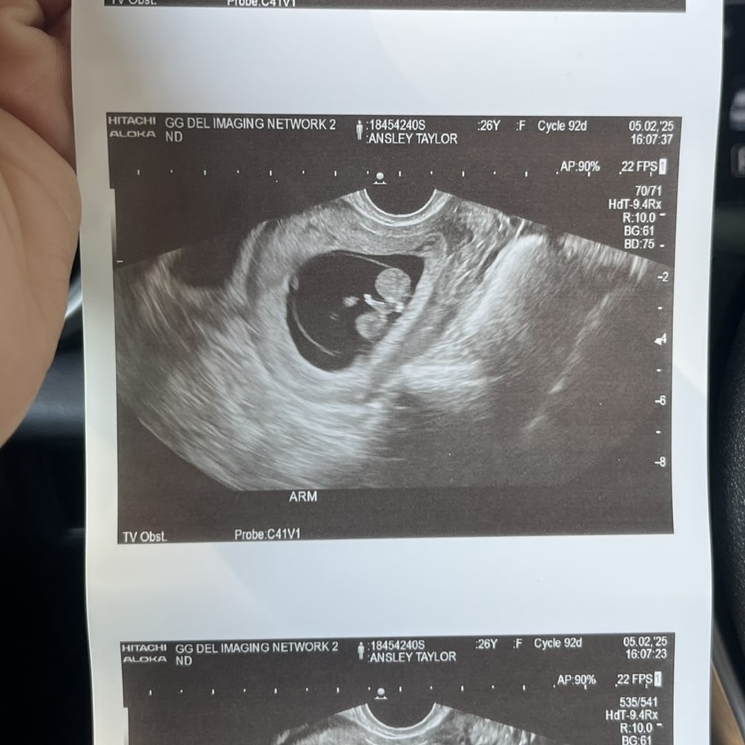 Photo shared by Justin for their Babylist baby registry.