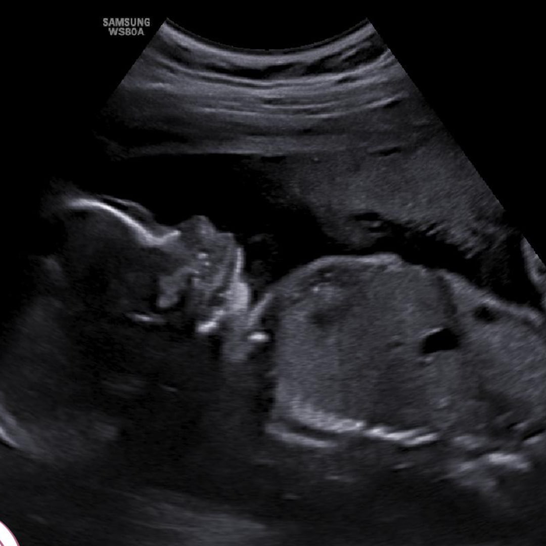 Photo shared by Alexis for their Babylist baby registry.