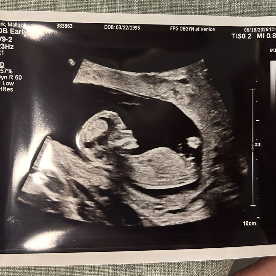 Photo shared by Mallory for their Babylist baby registry.
