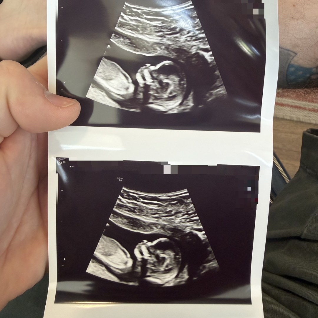 Photo shared by Ryan for their Babylist baby registry.