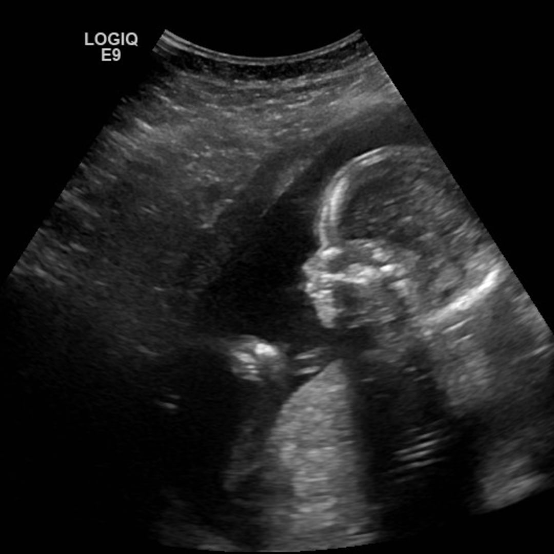 Photo shared by Emely for their Babylist baby registry.