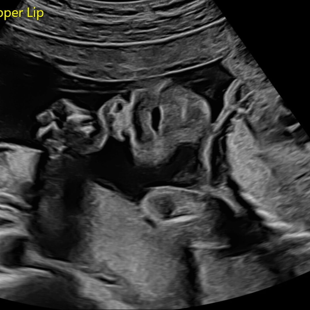 Photo shared by Paige for their Babylist baby registry.