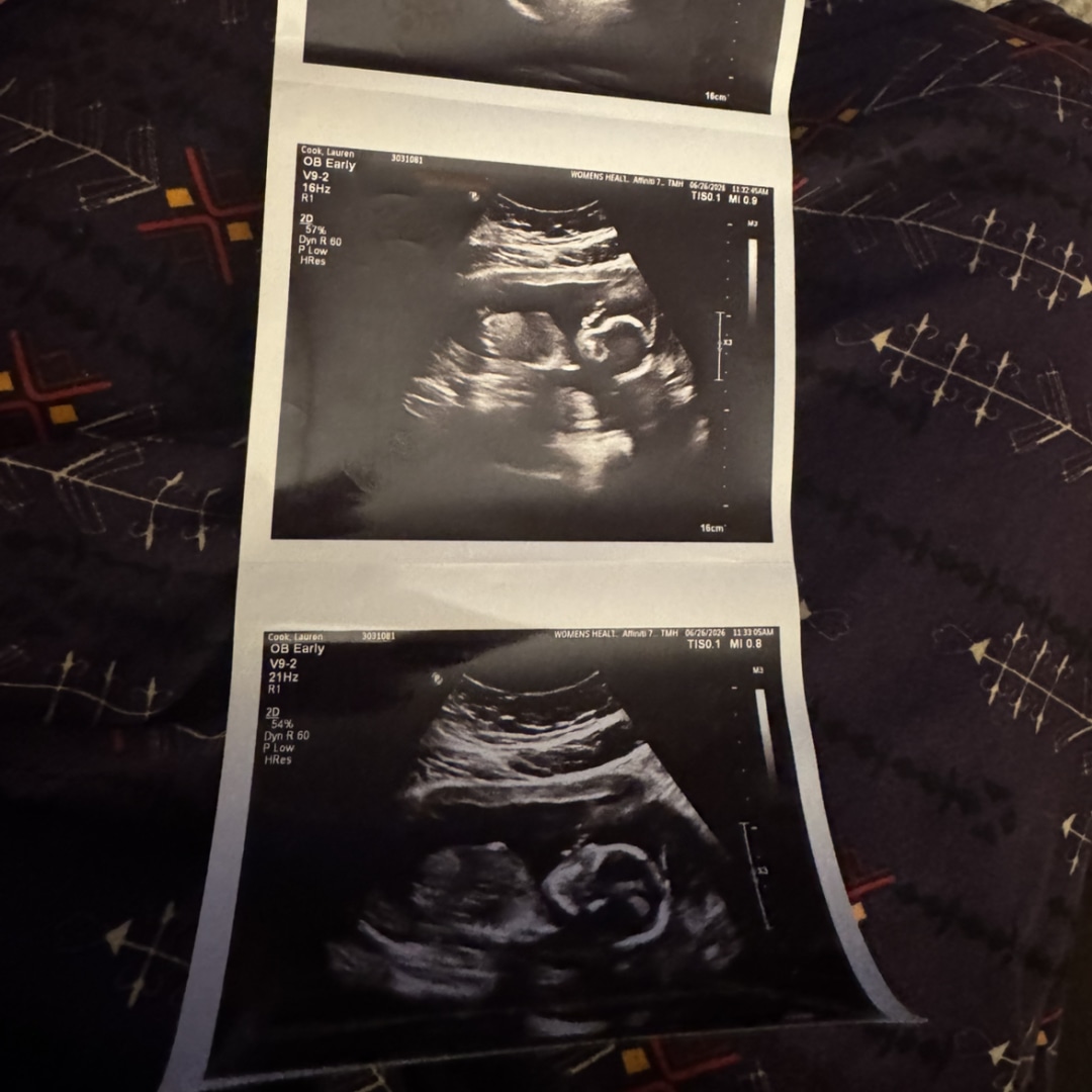 Photo shared by Lauren for their Babylist baby registry.