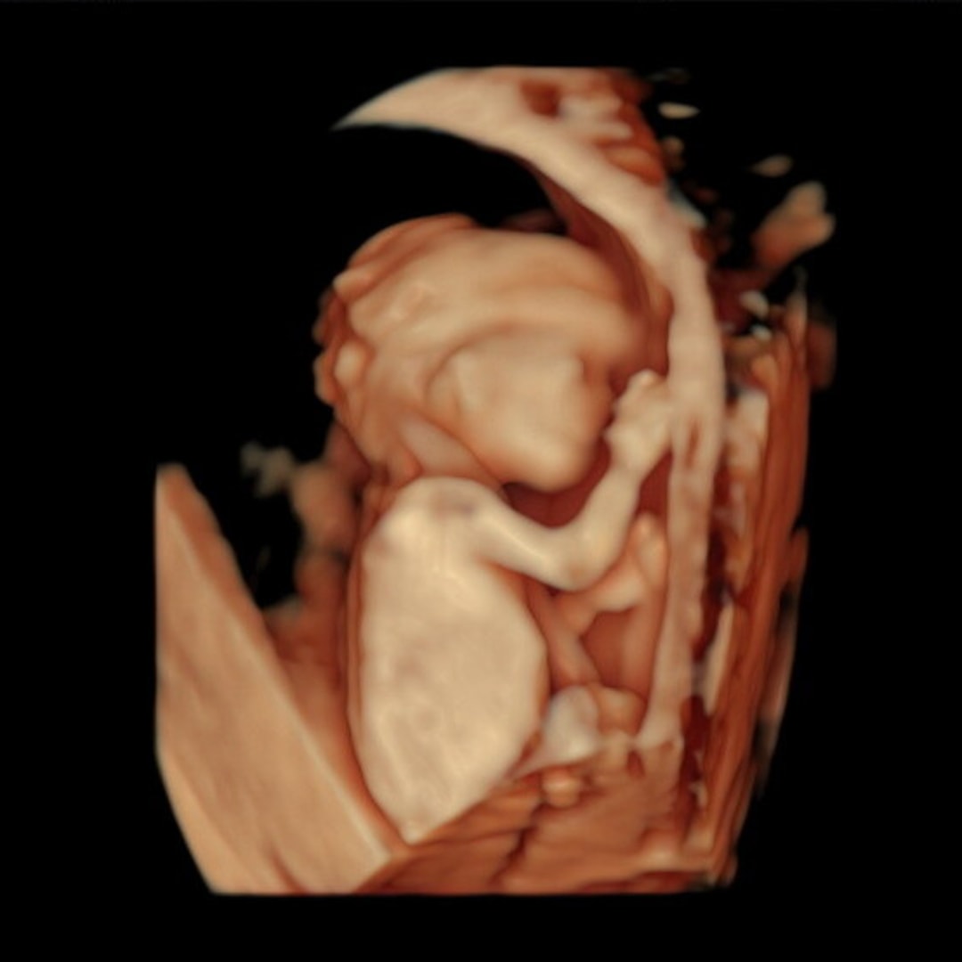 Photo shared by Alli for their Babylist baby registry.
