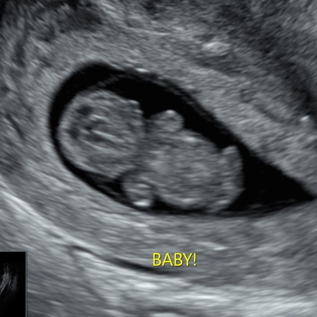 Photo shared by Delilah for their Babylist baby registry.