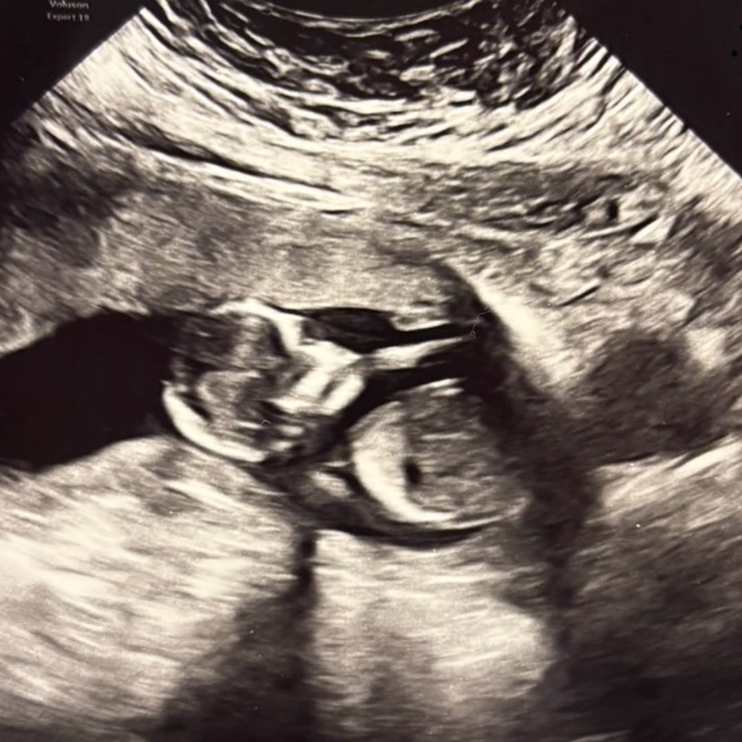 Photo shared by Aeris for their Babylist baby registry.