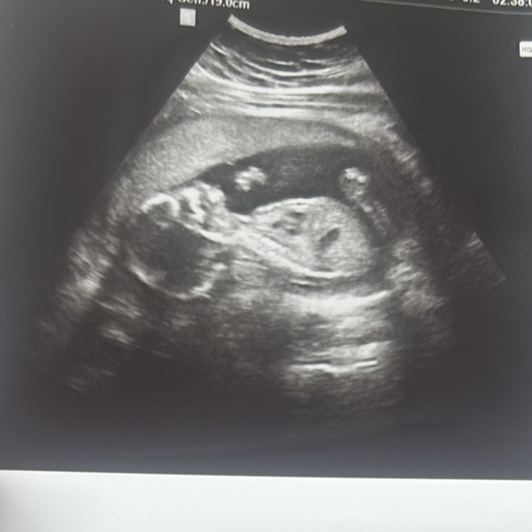 Photo shared by Kylie for their Babylist baby registry.