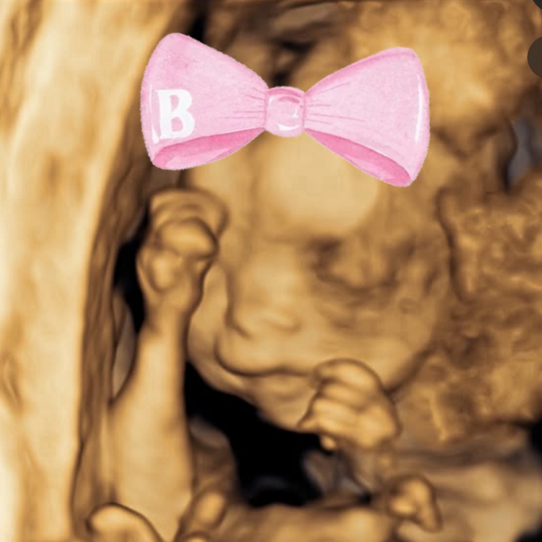 Photo shared by Bella for their Babylist baby registry.