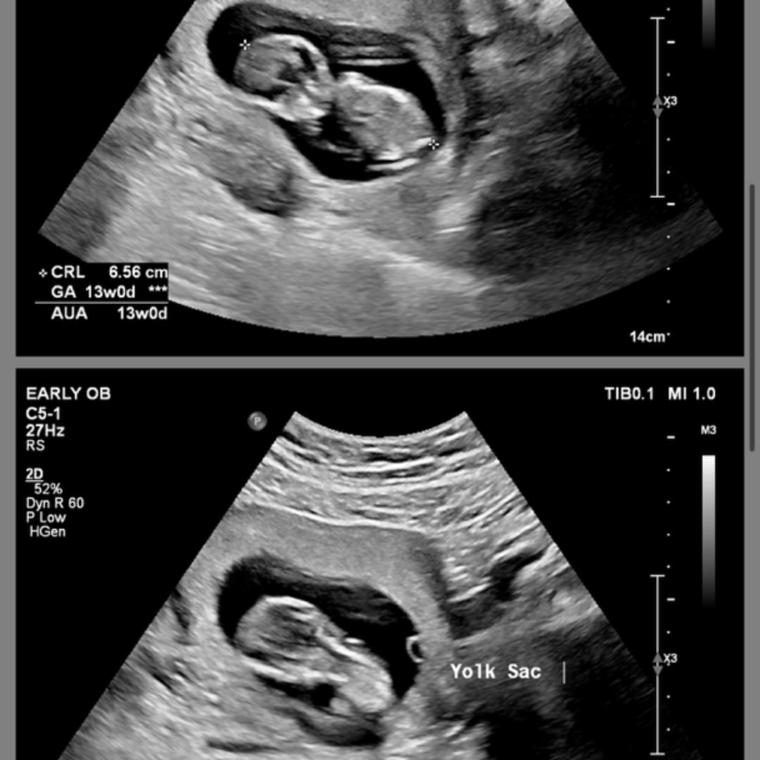 Photo shared by Adela for their Babylist baby registry.