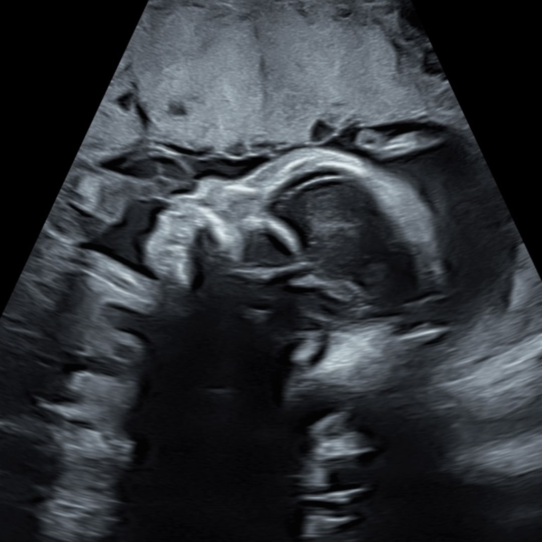 Photo shared by Breanna for their Babylist baby registry.