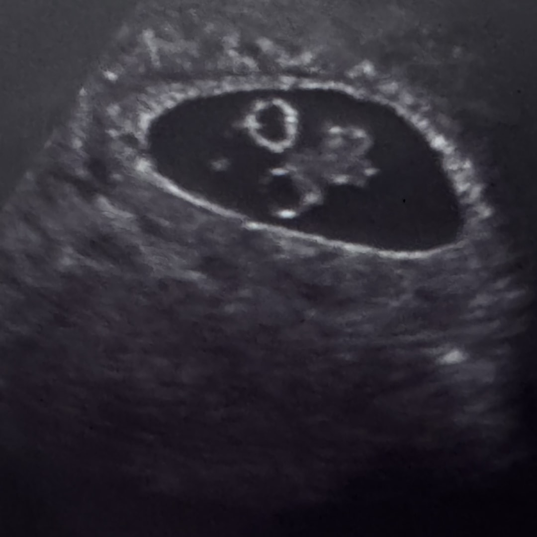 Photo shared by Mele for their Babylist baby registry.