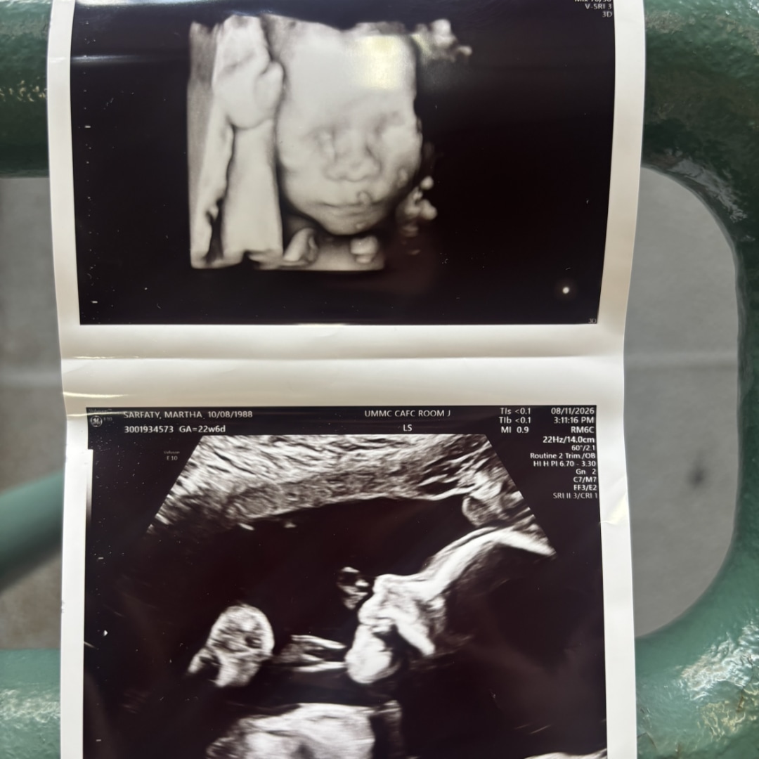 Photo shared by Marti for their Babylist baby registry.