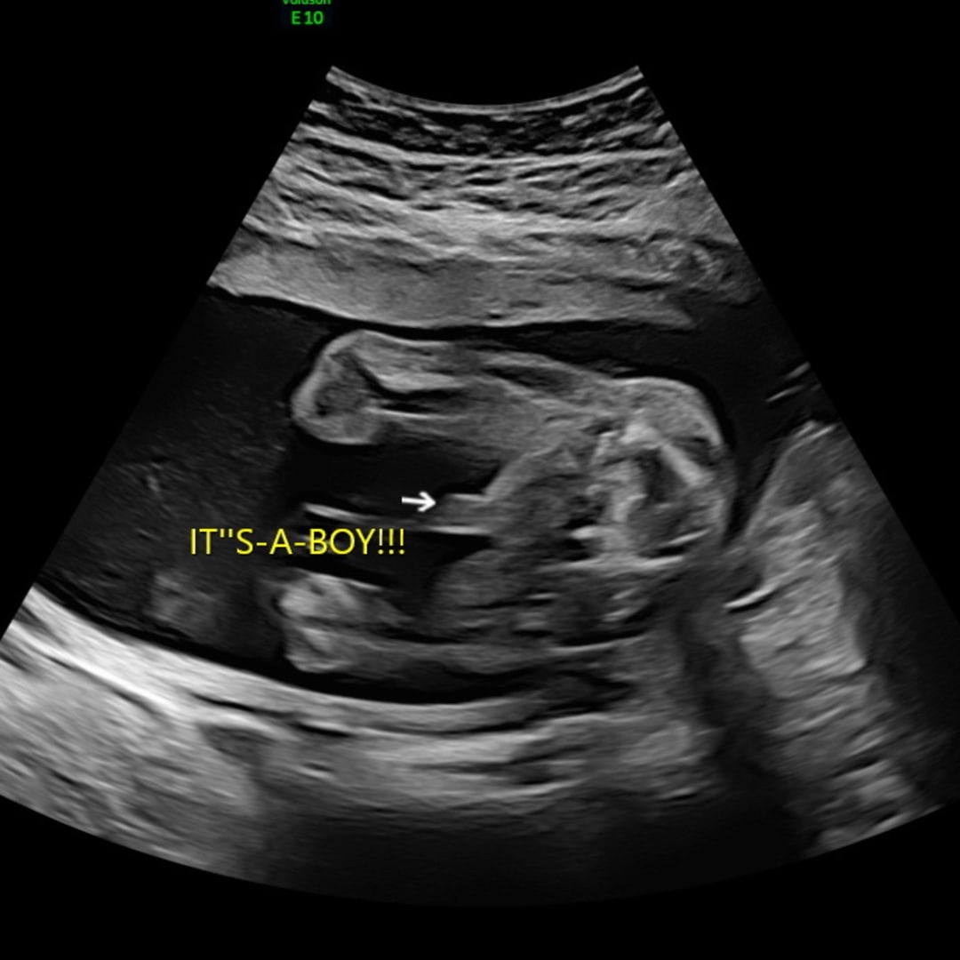 Photo shared by Grayce for their Babylist baby registry.