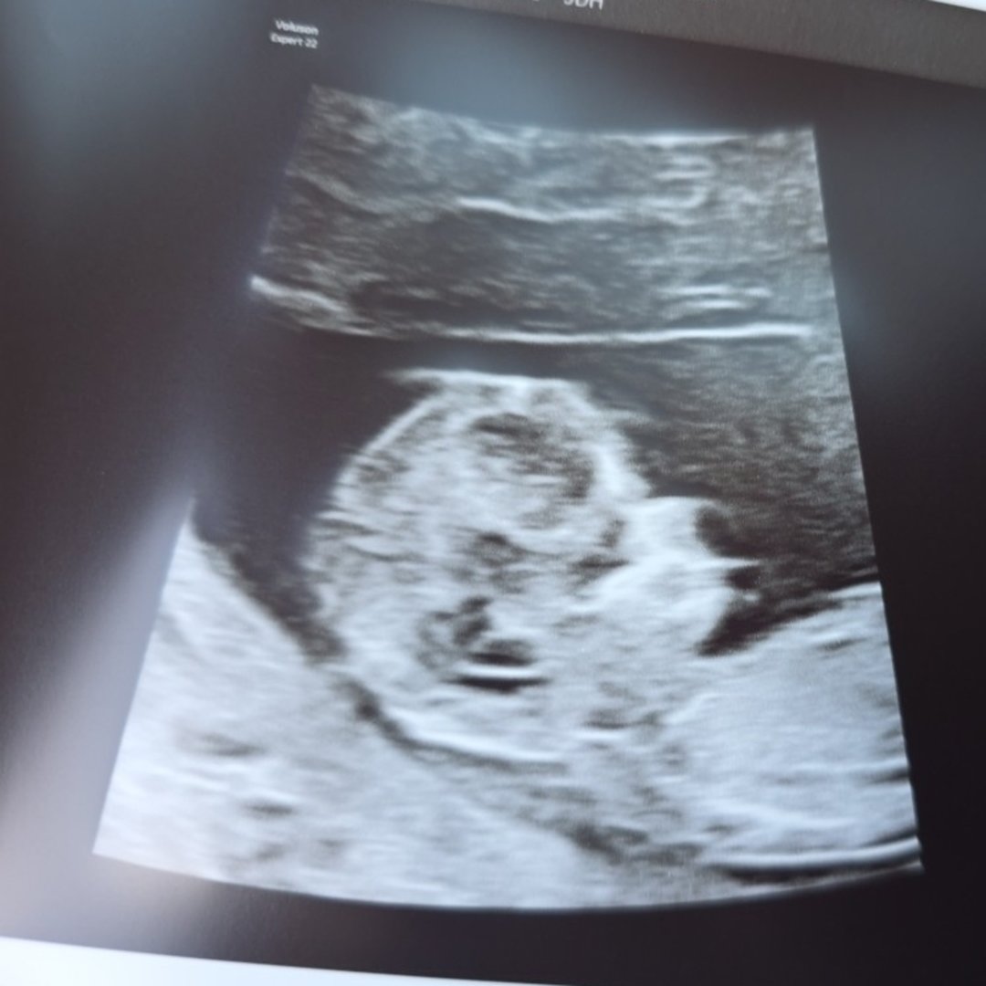 Photo shared by Natali for their Babylist baby registry.
