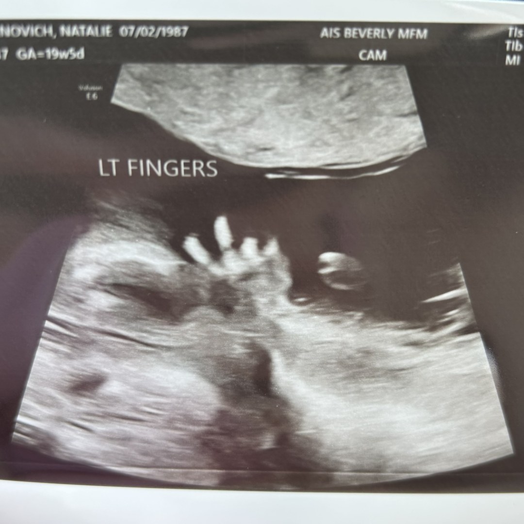 Photo shared by Natalie for their Babylist baby registry.