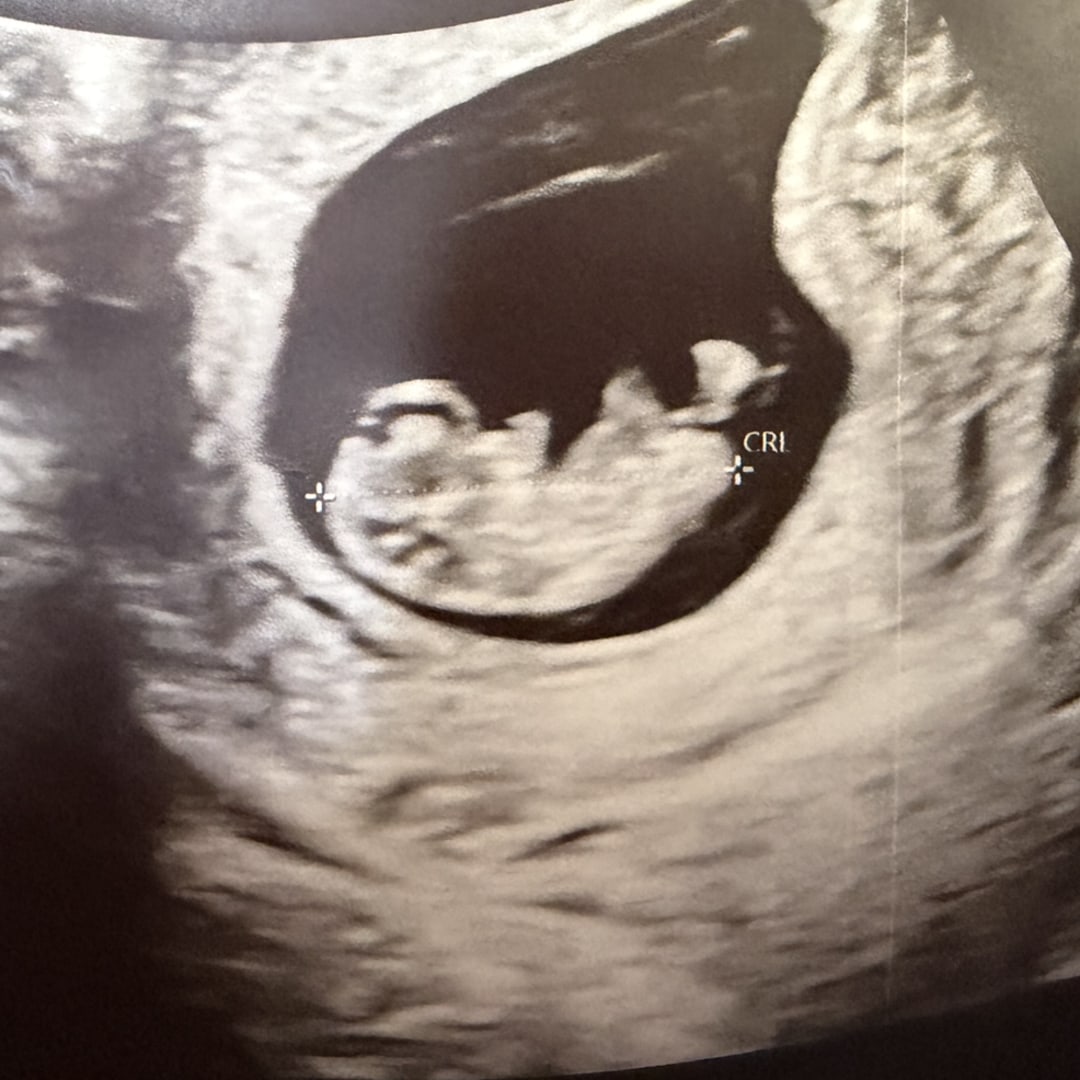 Photo shared by Paolina for their Babylist baby registry.