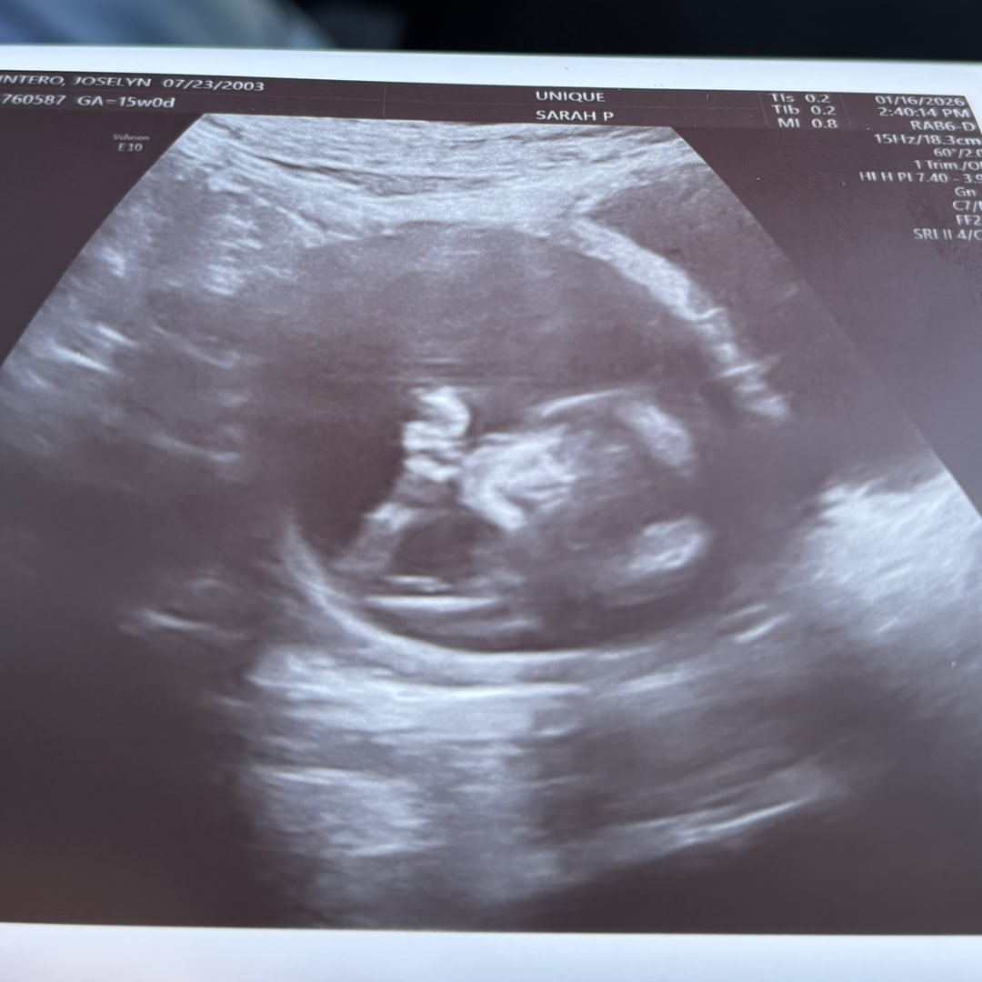 Photo shared by Joselynn for their Babylist baby registry.