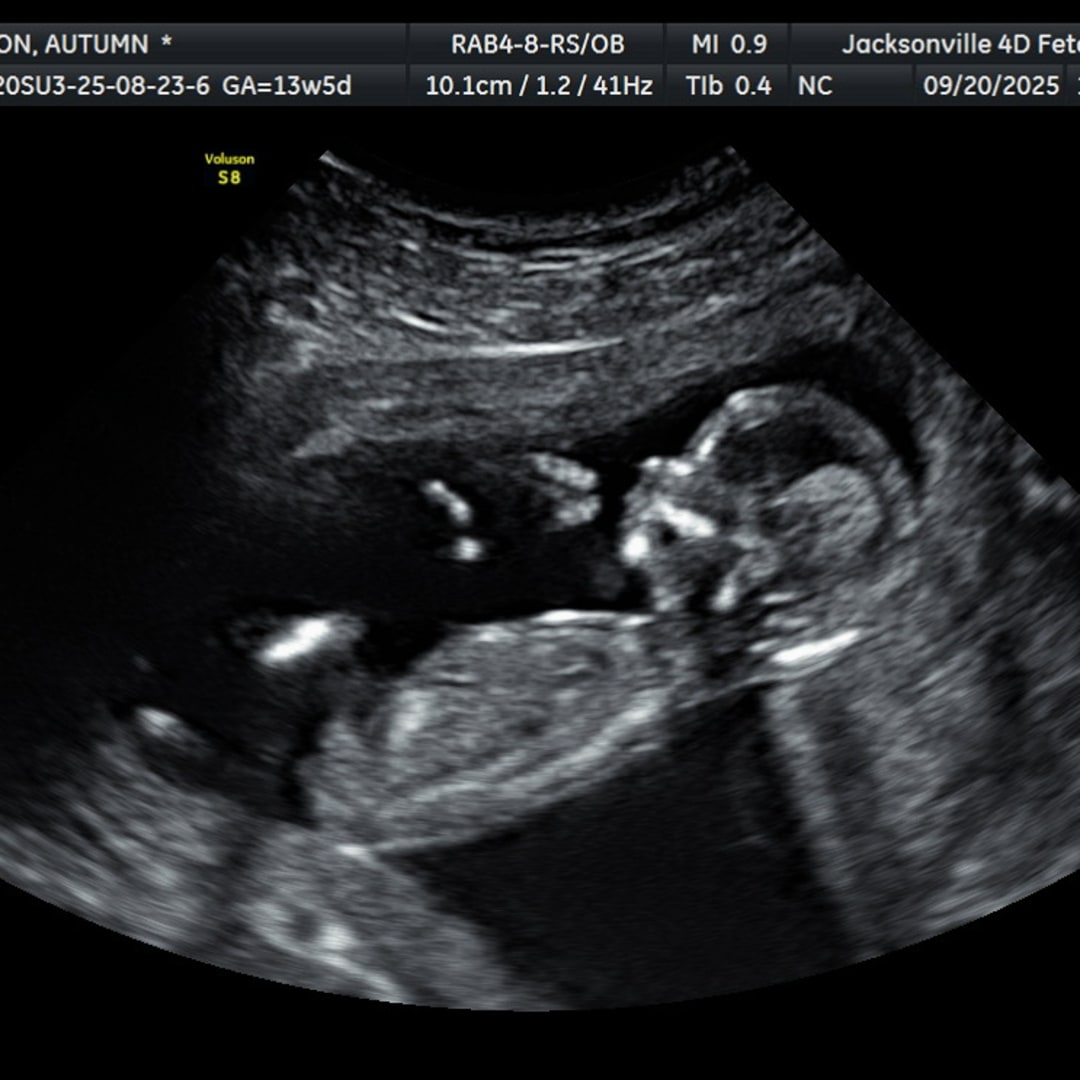 Photo shared by Autumn for their Babylist baby registry.