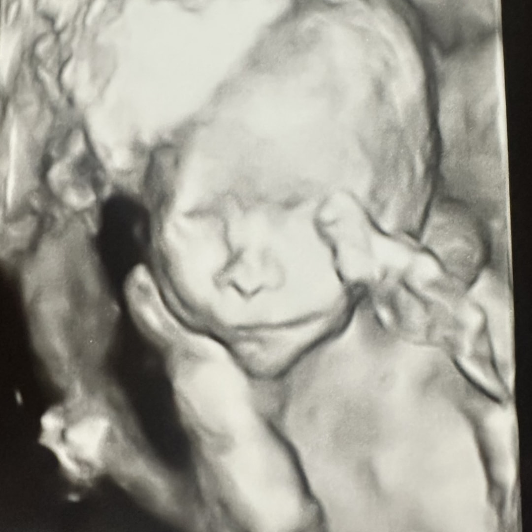 Photo shared by Molly for their Babylist baby registry.