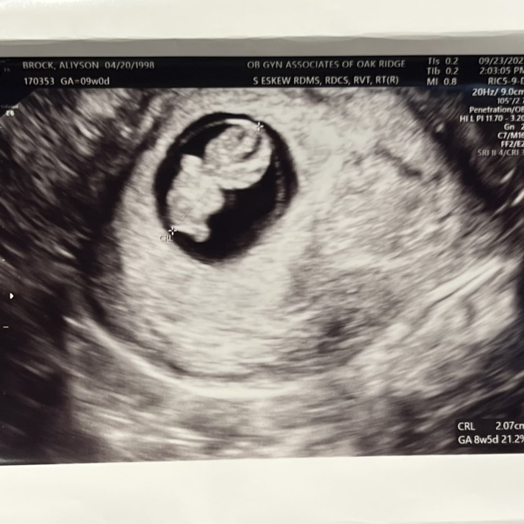 Photo shared by Aliyson for their Babylist baby registry.