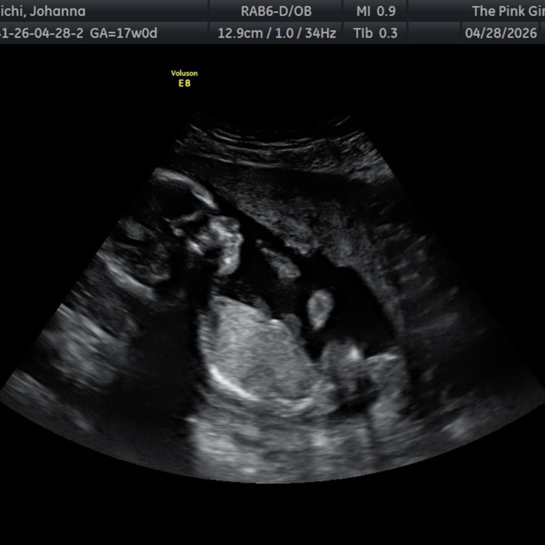 Photo shared by Johanna for their Babylist baby registry.