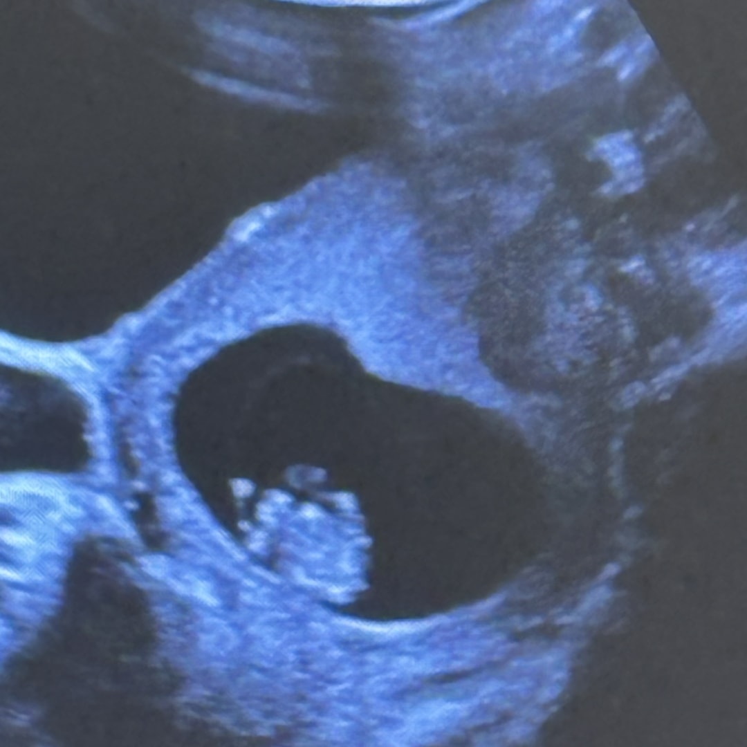 Photo shared by Amy for their Babylist baby registry.