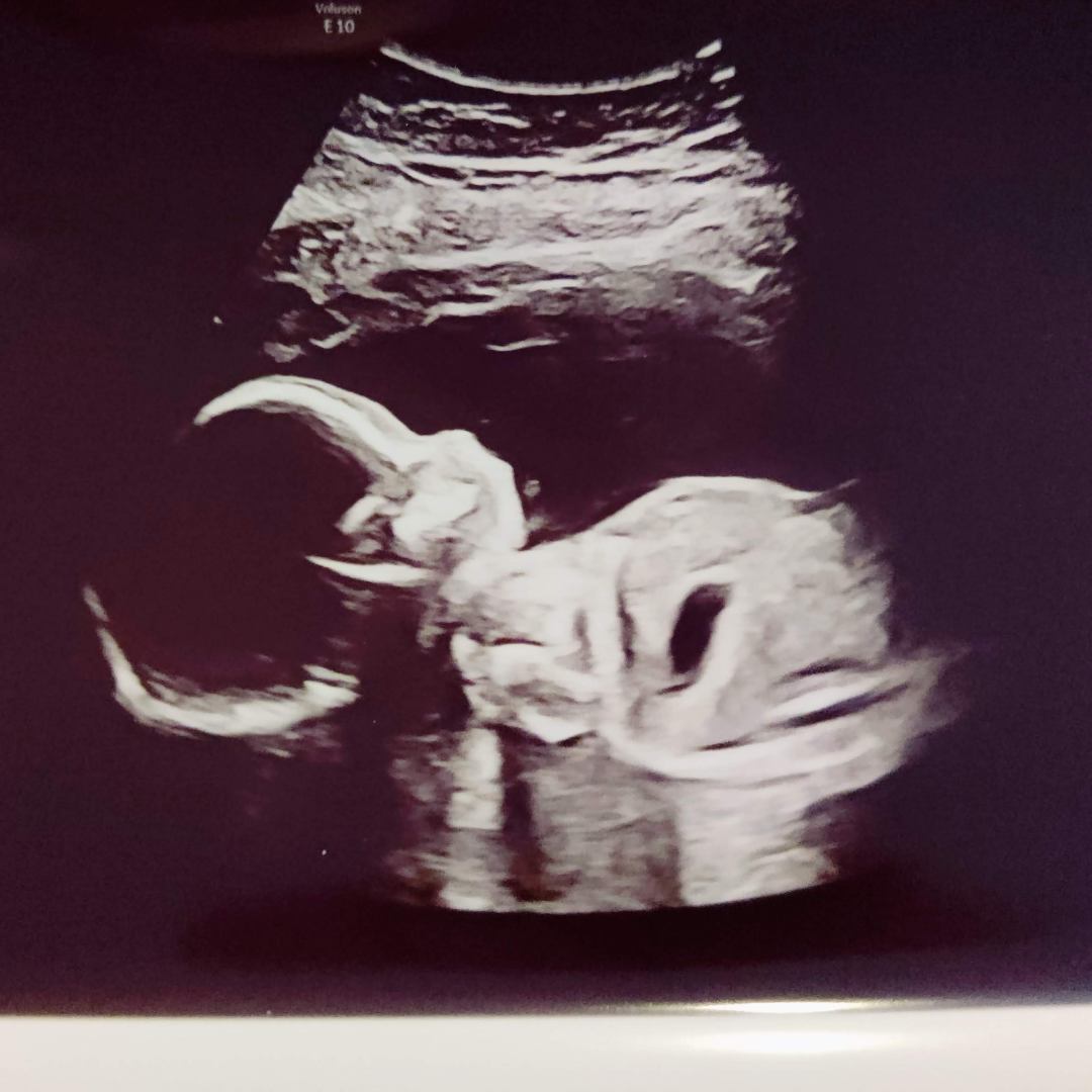 Photo shared by Natalia for their Babylist baby registry.