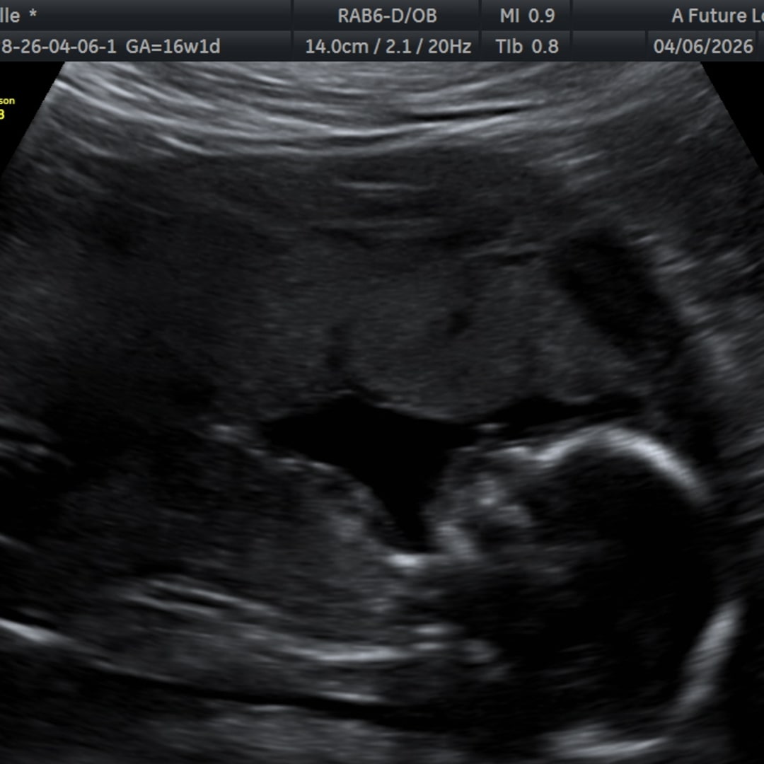 Photo shared by Jazzelle for their Babylist baby registry.