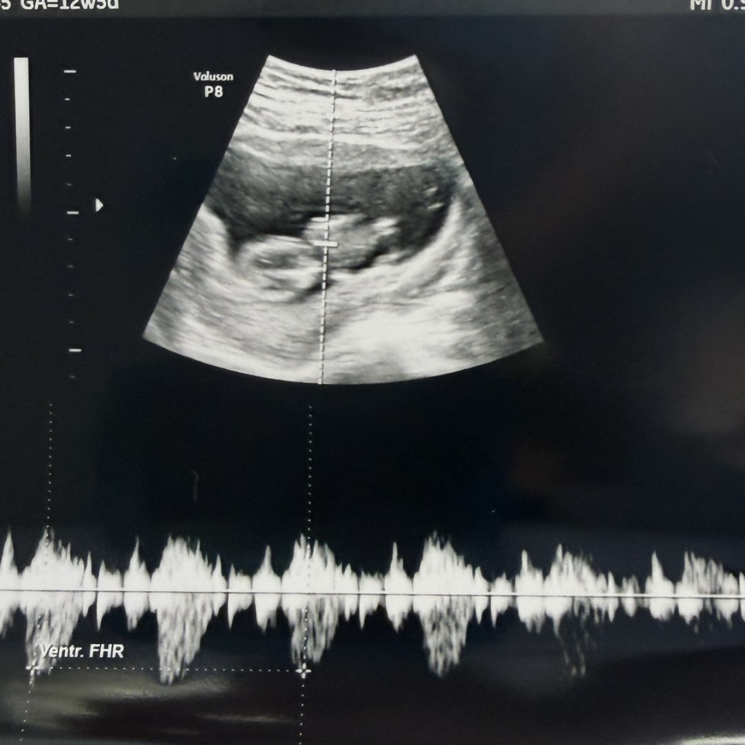 Photo shared by Katie & for their Babylist baby registry.