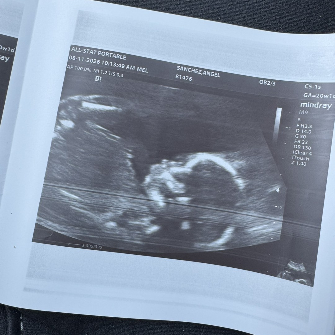 Photo shared by Angel for their Babylist baby registry.
