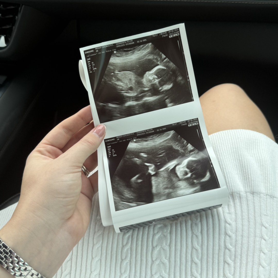Photo shared by Heleri for their Babylist baby registry.
