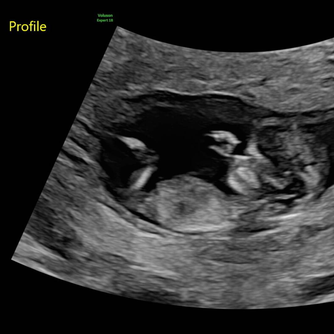 Photo shared by Baby for their Babylist baby registry.