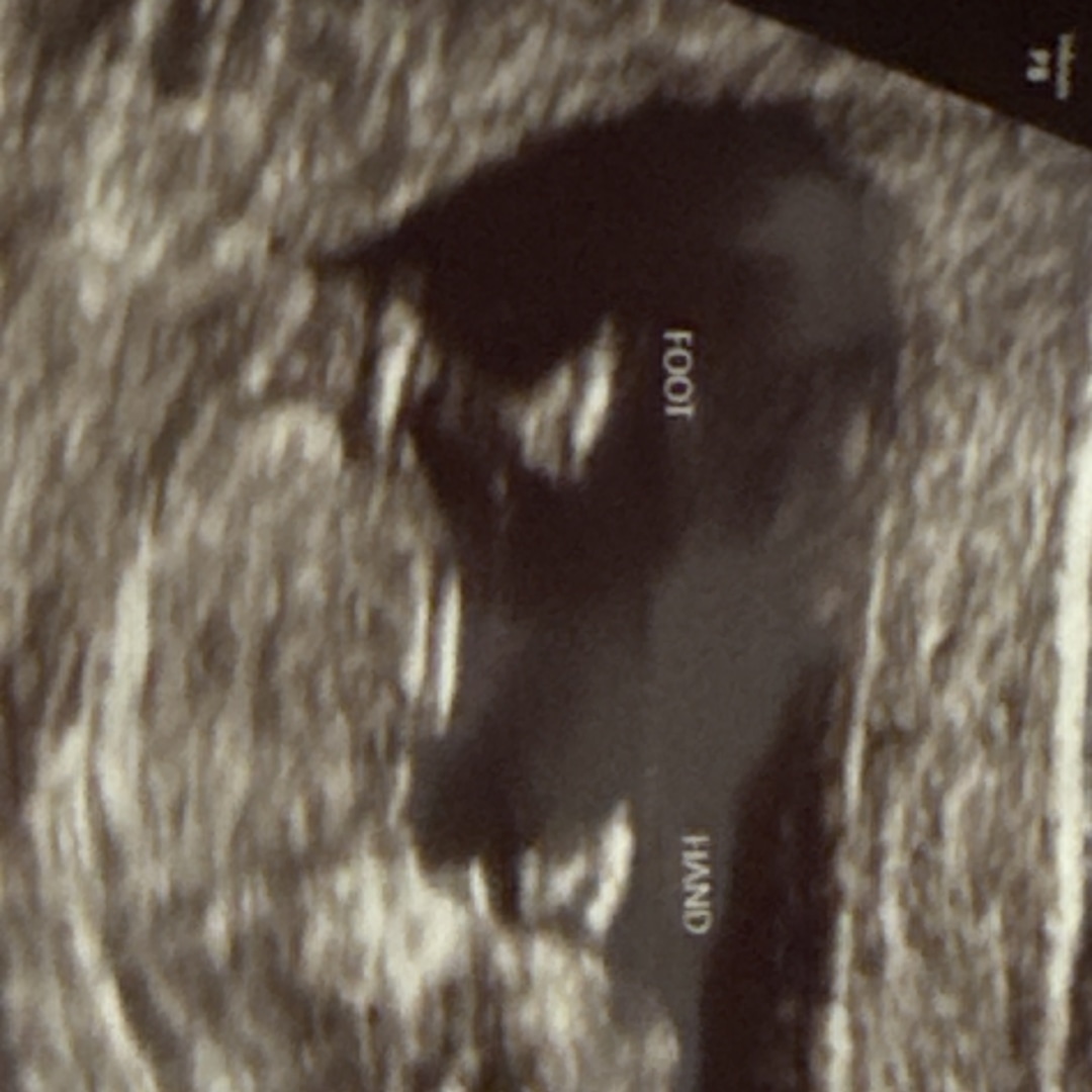 Photo shared by A’Nyia for their Babylist baby registry.