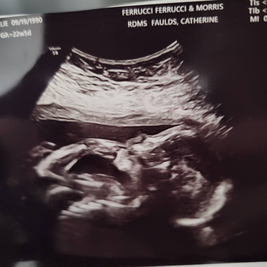 Photo shared by Mollie for their Babylist baby registry.